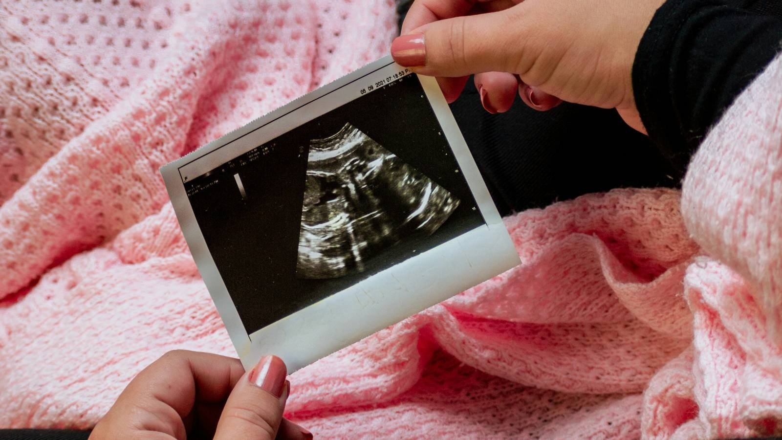 Corte Suprema ordenó a Fonasa estudiar ingreso de pareja del mismo sexo a programa de fertilización asistida